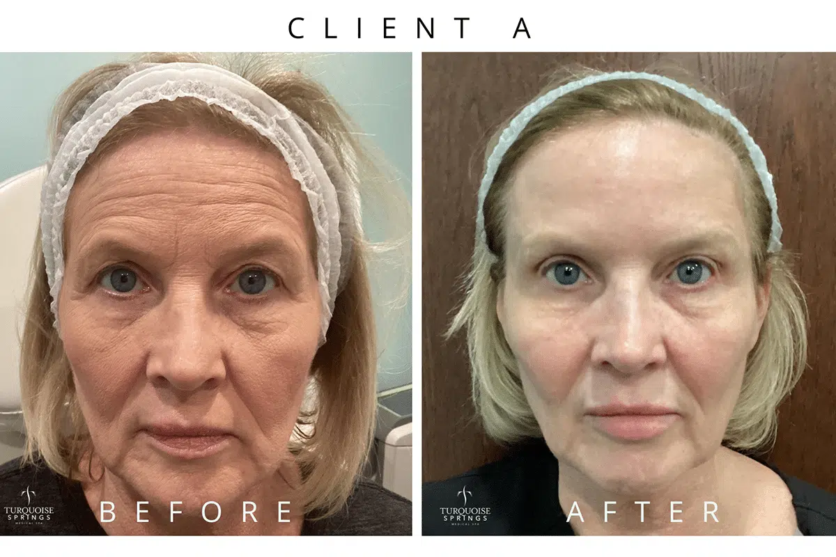 CLIENT A CLIENT A